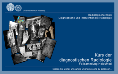 Grafik zur Radiologischen Fallsammlung