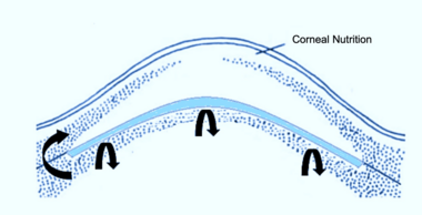 Schematische Darstellung der Hornhaut