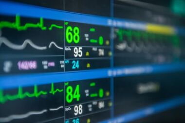 Stroke Unit Monitoring