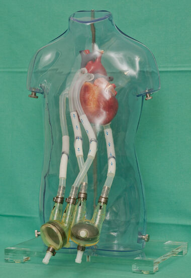 Berlin Heart EXCOR® BIVAD Berlin Heart EXCOR® BIVAD