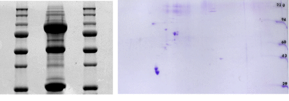 Original-Resultate eines Pull-down Assays (links) und einer zwei-dimensionalen Gelelektrophorese (rechts). Die Coomassie blau-gefärbten Gele zeigen Ionenkanäle und assoziierte Proteine nach immunologischer Aufreinigung. Einzelne Banden bzw. „spots“ 