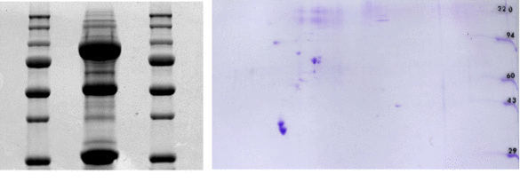 Original-Resultate of Pull-down Assays (left) und einer zwei-dimensionalen Gelelektrophorese (rechts). Die Coomassie blau-gefärbten Gele zeigen Ionenkanäle und assoziierte Proteine nach immunologischer Aufreinigung. Einzelne Banden bzw. „spots“ 