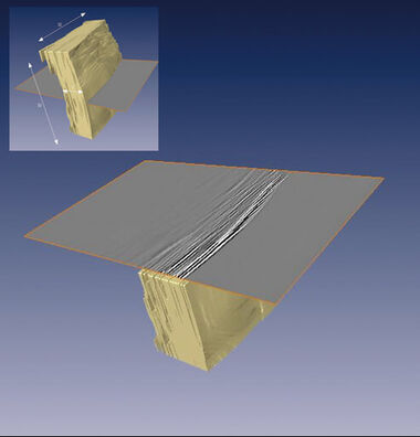 3D-Scan des Schädelknochens 3D-Scan des Schädelknochens