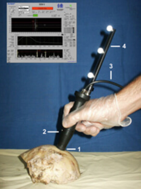 Der SonoPointer® Der SonoPointer®