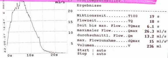 Abbildung: „Normale“ Uroflowmetriekurve Abbildung: „Normale“ Uroflowmetriekurve