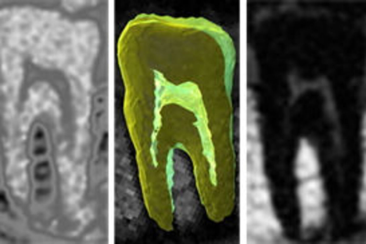 Dental MRT